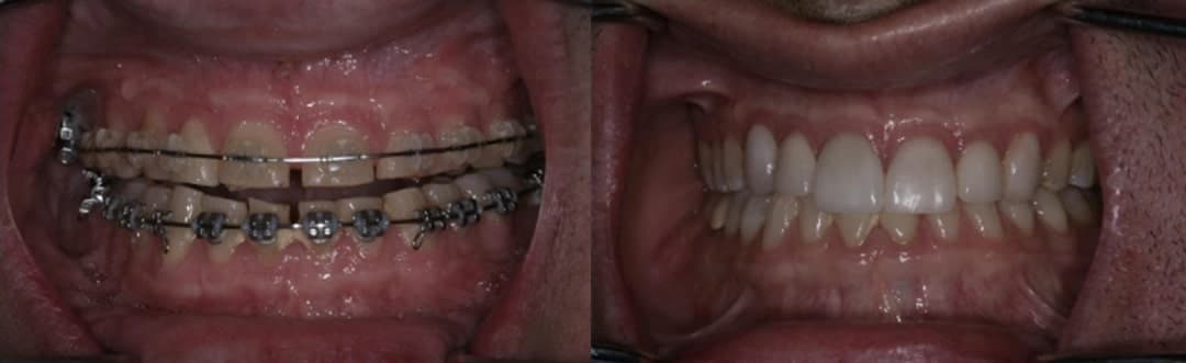 Winnetka Dentist